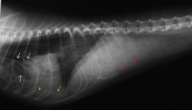 Radiograph of thorax